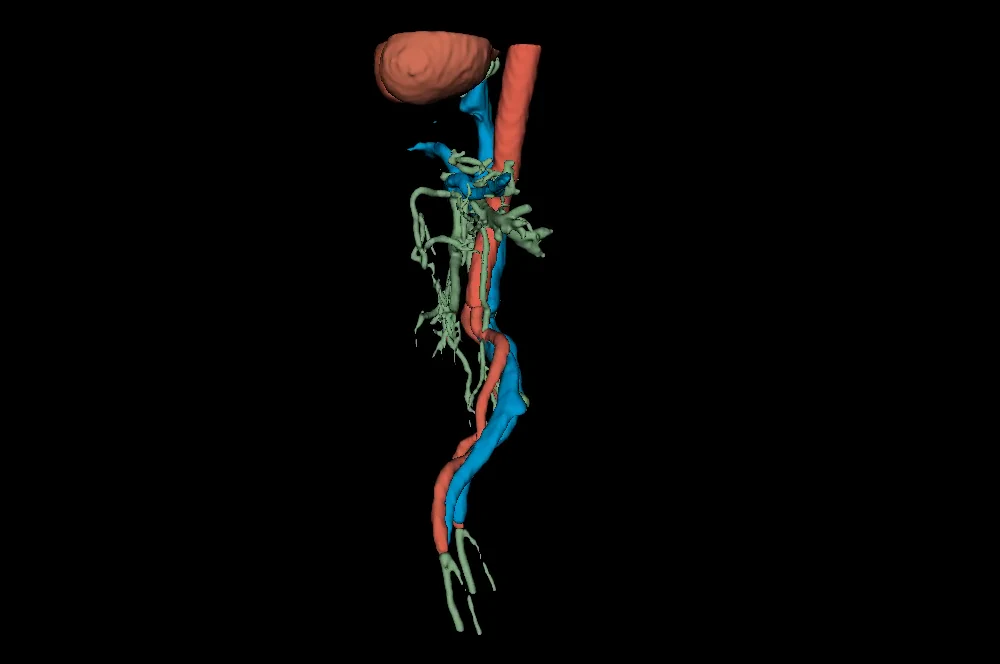 Cardiac and vascular segmentation including the aorta, vena cava, and portal vessels