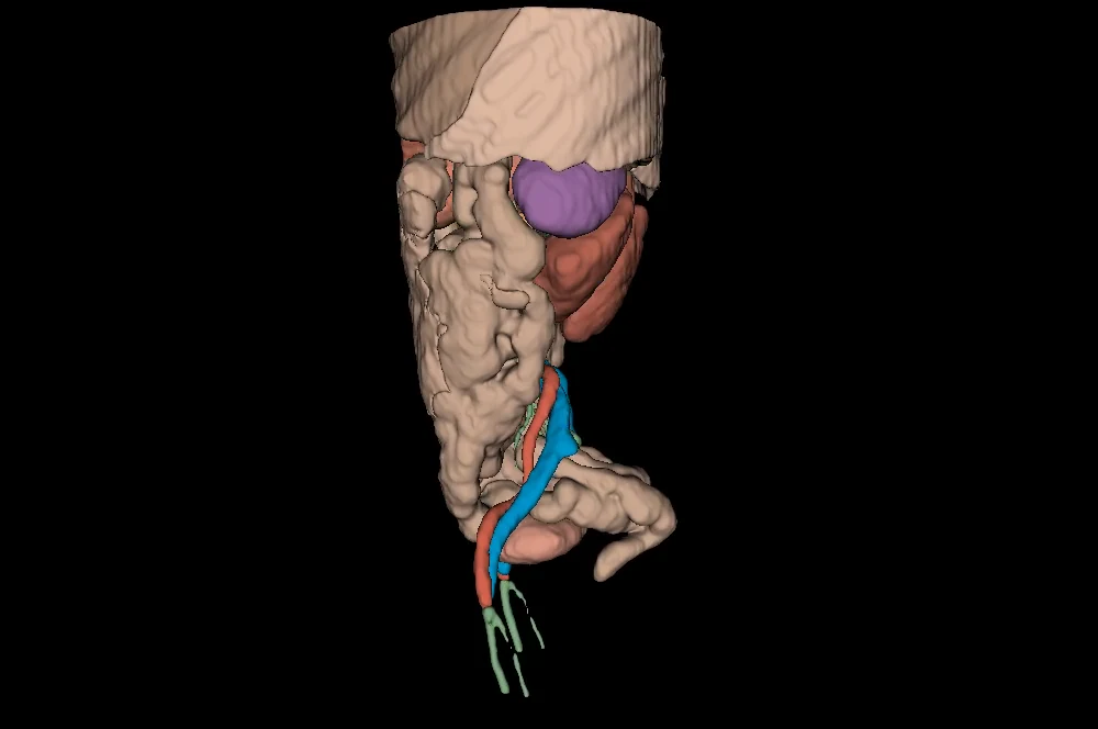 Abdominal organ segmentation isolated from the CT volume