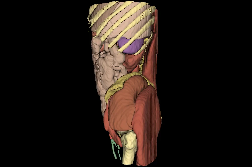 Full anatomical segmentation with organs, ribs, spine, and musculature